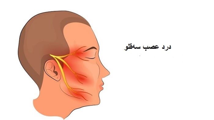 درد عصب سه قلو (نورالژی تری ژمینال) چگونه درمان می‌شود؟