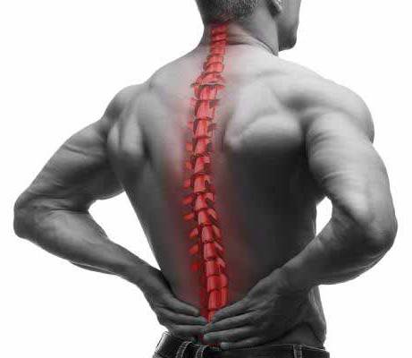 علت، علائم و درمان اسپوندیلیت آنکیلوزان با دارو، ورزش و جراحی