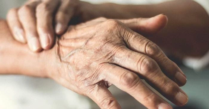 بیماری پارکینسون: 5 مرحله رشد بیماری، علائم، تشخیص و درمان