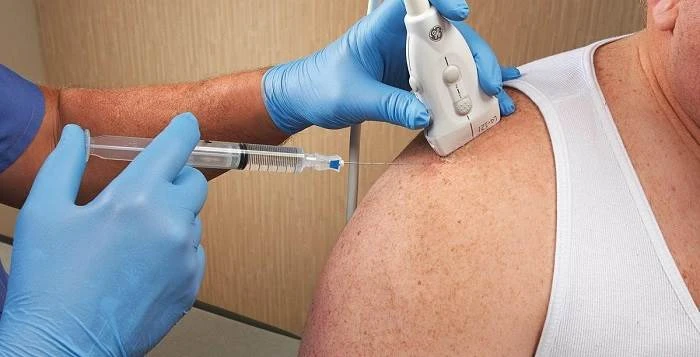 عوارض و نحوه تزریق کورتون به کمر، زانو، شانه، مچ دست و پاشنه پا