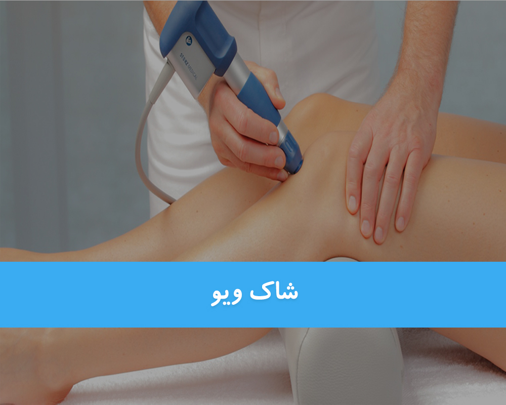 شاک ویو
