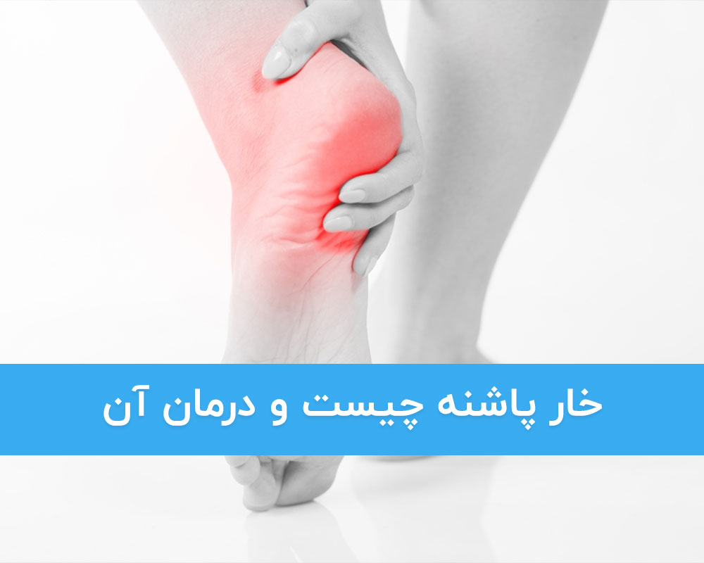 خار پاشنه چیست و درمان آن