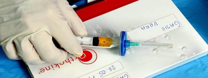 نحوه انجام، مزایا و هزینه ارتوکین تراپی