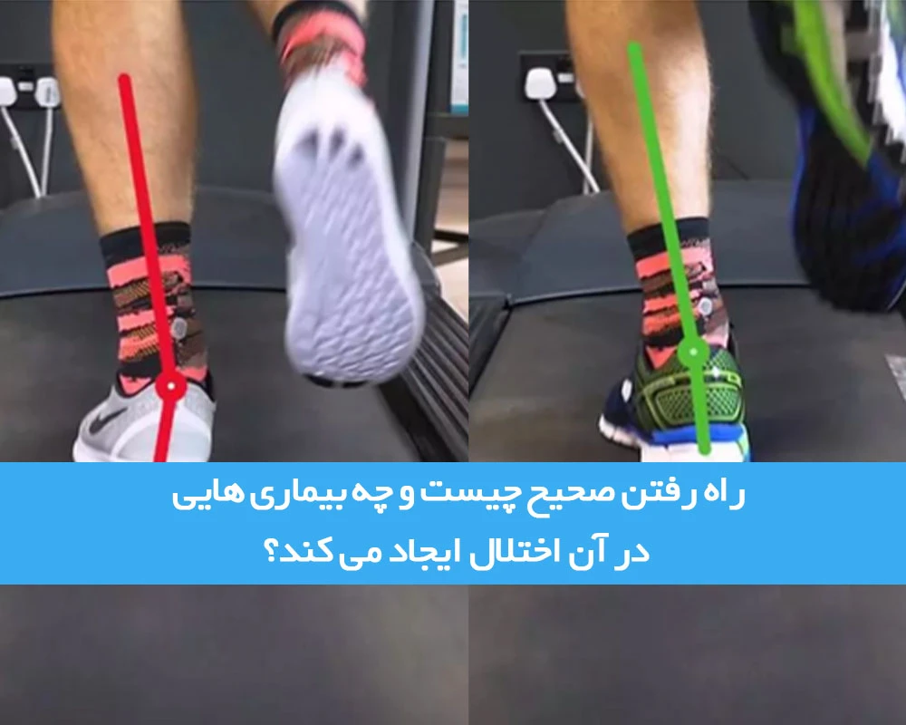 راه رفتن صحیح چیست و چه بیماری هایی در راه رفتن اختلال ایجاد می کند؟