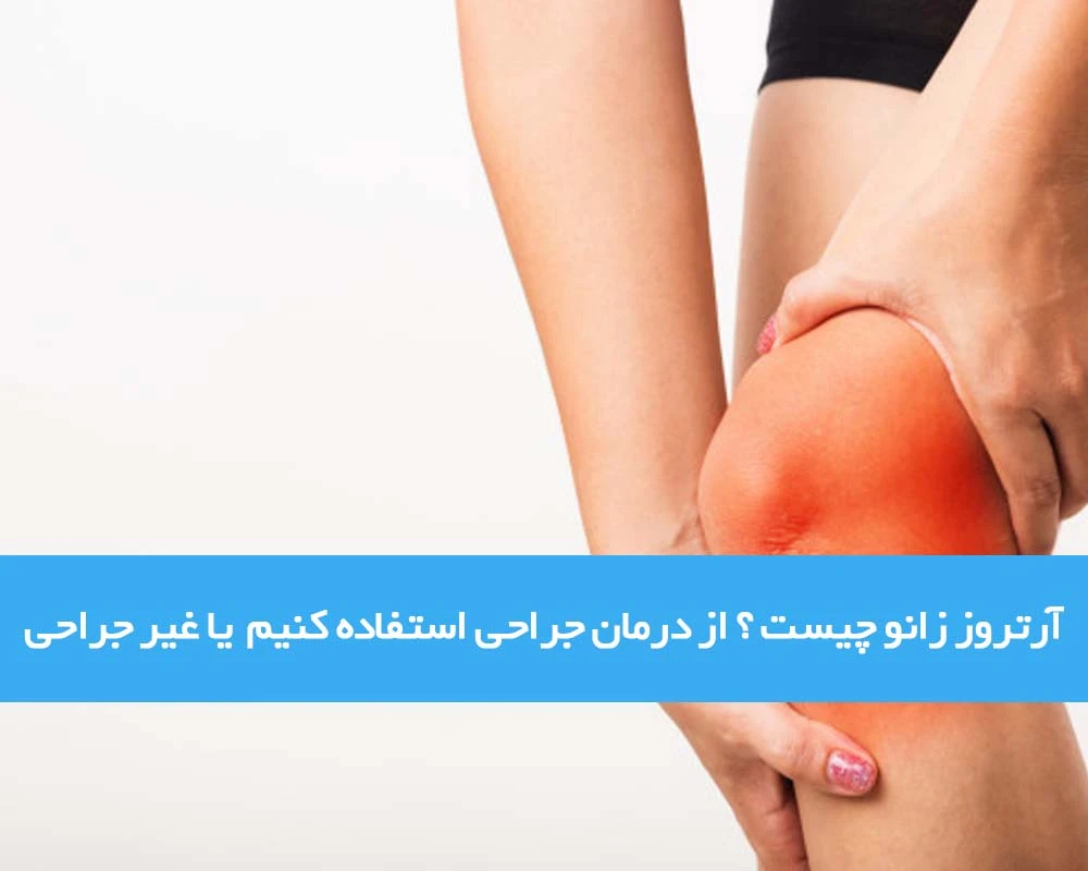 آرتروز زانو چیست ؟ از درمان جراحی استفاده کنیم یا غیر جراحی