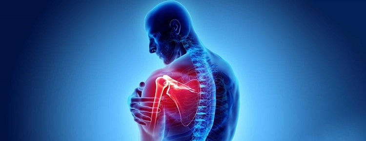 آرتروز شانه چه علائمی دارد و بهترین درمان آن چیست؟