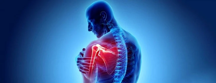 آرتروز شانه چه علائمی دارد و بهترین درمان آن چیست؟