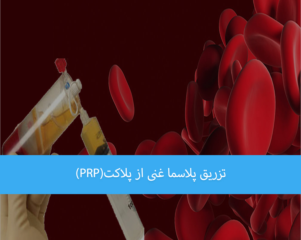 تزریق PRP