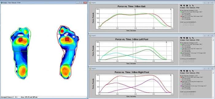 اندازه‌گیری توزیع فشار و نیروی کف پایی