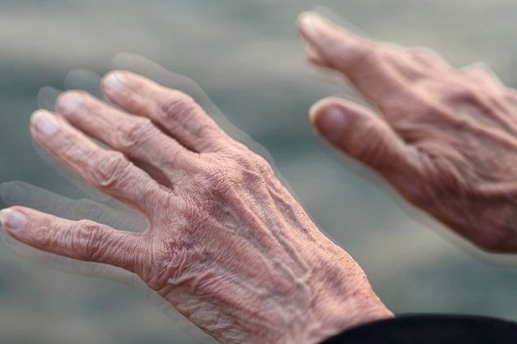 درمان پارکینسون - توصیه های تغذیه ای برای بیماران مبتلا به پارکینسون