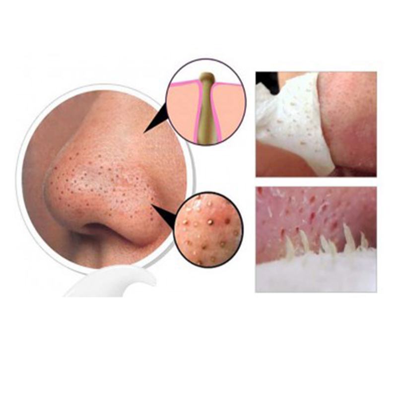 چسب بینی زغال FENMAN