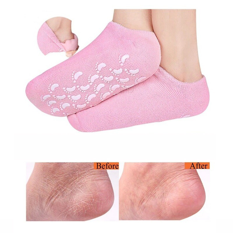 جوراب-سیلیکونی-رفع-ترک-پا (2)