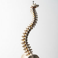 محصولات ارتوپدی