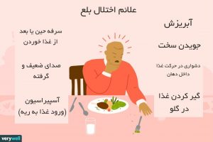 اختلال بلع