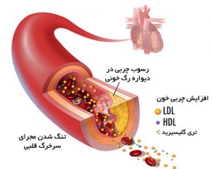 علل گزگز دست و پا