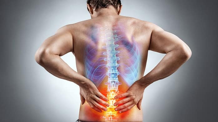 علائم فتق دیسک