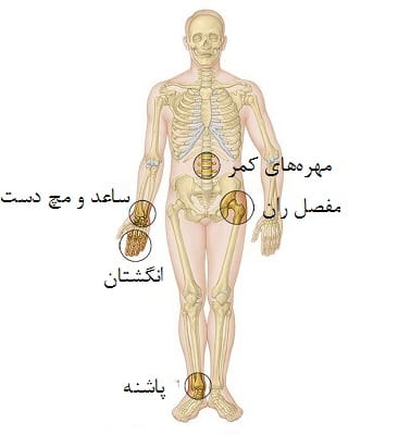 محل‌هایی که از آن‌ها سنجش تراکم استخوان به عمل می‌آید