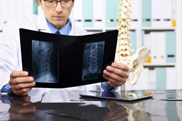 تشخیص دیسک کمر با ام آر آی و با سی تی اسکن