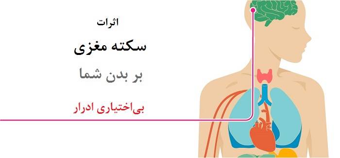 اثرات سکته مغزی بر بدن - بی اختیاری ادرار