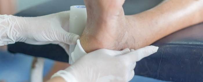 مراقبت از زخم پای دیابتی