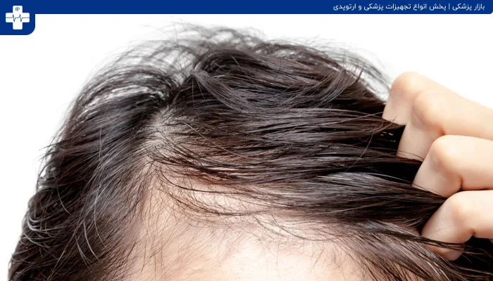 روش های قطع ریزش مو