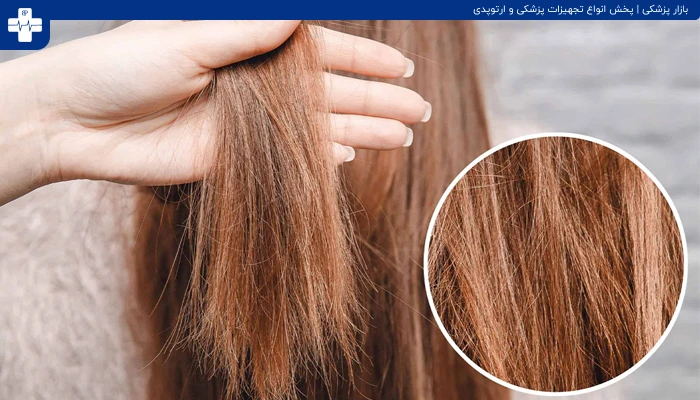 آسیب مو
