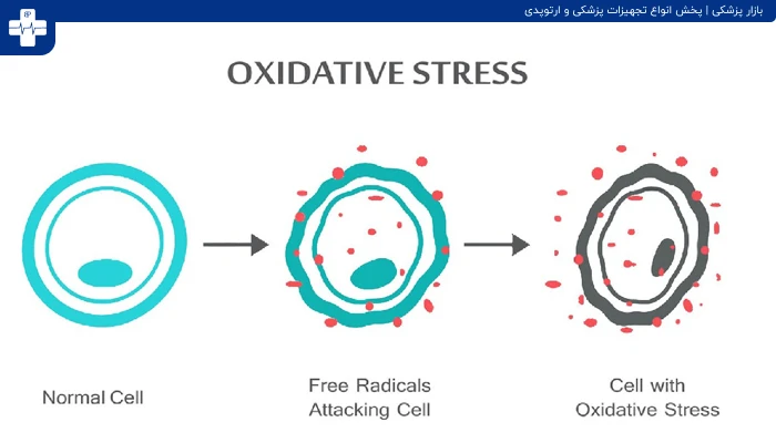 استرس اکسیداتیو