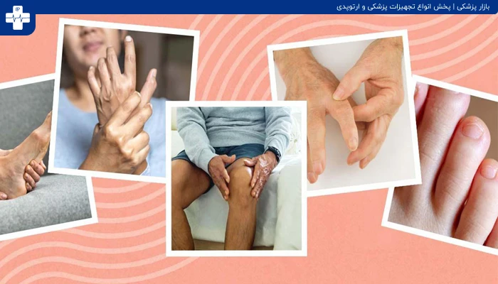 بیماری التهاب مفاصل