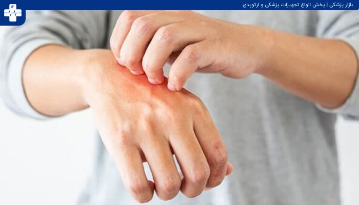 بیماری سلیاک
