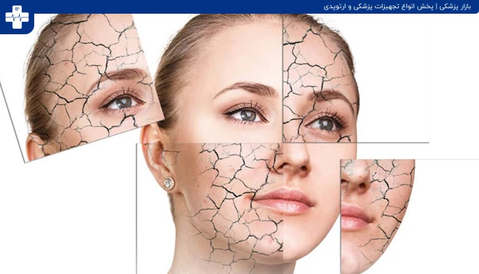 خشکی پوست