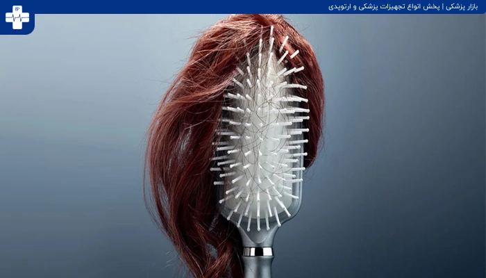 ریزش مو