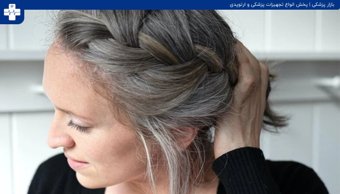 سفید شدن مو