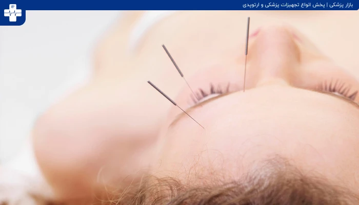 لاغری صورت